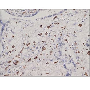 CD163 (DB 045) avatar