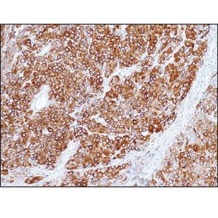 Melan A (DB 050) avatar