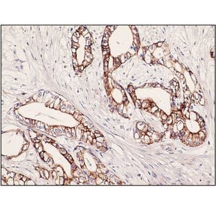 Cytokeratin 7 (DB 051) avatar