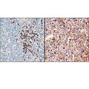 Human Kappa light chain (DB 037)