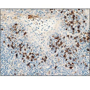 Human Lambda light chain (DB 039) avatar