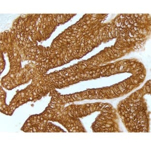 ImmPACT DAB EqV avatar