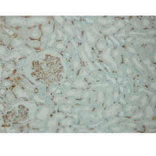 C4d complement (DB 107) avatar