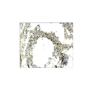 CD68 Antibody avatar