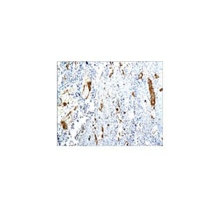 CD31 Antibody avatar