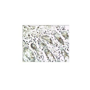 CD20 Antibody avatar