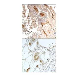 CD31 (N-term) Antibody avatar