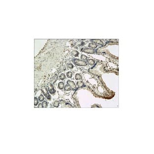 IL-10 Antibody avatar